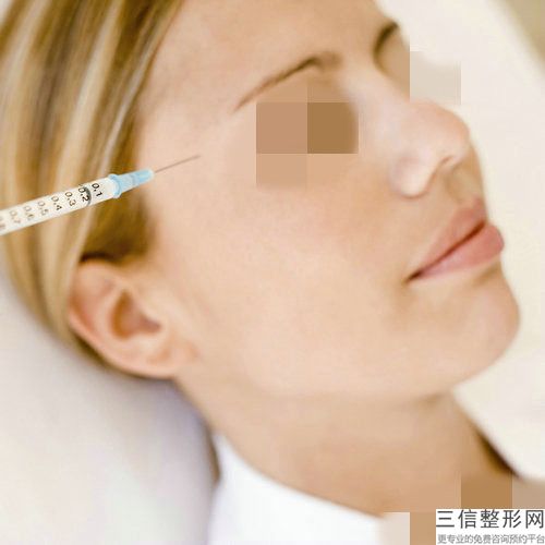 济南市何茂文整形医生自体肋软骨隆鼻一般价格要多少