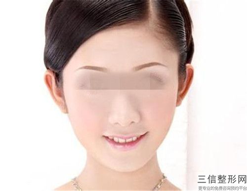 东莞市脸上长雀斑祛除收费明细免费一览(脸上长雀斑祛除价格应该是多少)